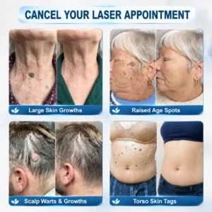 𝐎𝐟𝐟𝐢𝐜𝐢𝐚𝐥 𝐁𝐫𝐚𝐧𝐝 𝐒𝐭𝐨𝐫𝐞 7-𝐷𝑎𝑦 𝗧𝐚𝐠 & 𝗦𝗽𝐨𝐭 𝐄𝐫𝒂𝒔𝒆𝒓(Zero Pain, Zero 𝐒𝐜𝐚𝒓𝒔 Rollerball) - Image 2