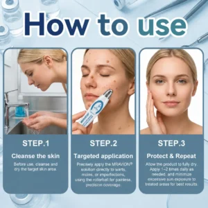 𝐎𝐟𝐟𝐢𝐜𝐢𝐚𝐥 𝐁𝐫𝐚𝐧𝐝 𝐒𝐭𝐨𝐫𝐞 7-𝐷𝑎𝑦 𝗧𝐚𝐠 & 𝗦𝗽𝐨𝐭 𝐄𝐫𝒂𝒔𝒆𝒓(Zero Pain, Zero 𝐒𝐜𝐚𝒓𝒔 Rollerball) - Image 4