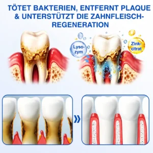 GumCare Pro | Zahnfleischpflege & Parodontal Gel - Image 7