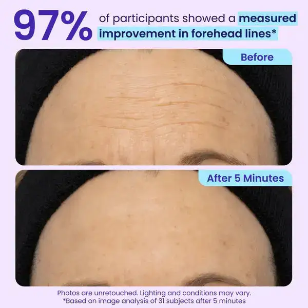 Eye Bag Instant Eraser - Image 6