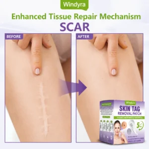 Soluble Microneedle Botanical Skin Tag Removal Patch - Image 9