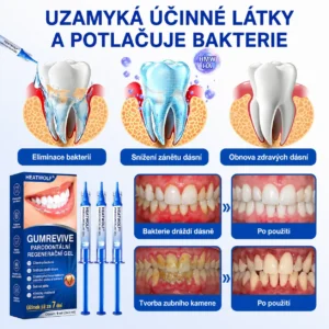 Parodontální opravný gel GumRevive | Úleva za 7 dní - Image 9