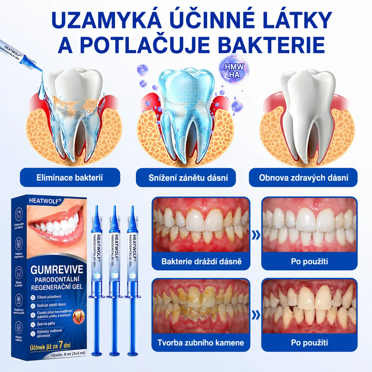 Parodontální opravný gel GumRevive | Úleva za 7 dní - Image 9
