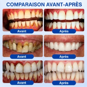 🦷 𝑮𝒖𝒎𝑹𝒆𝒗𝒊𝒗𝒆 𝑮𝒆𝒍 𝒅𝒆 𝑹é𝒑𝒂𝒓𝒂𝒕𝒊𝒐𝒏 𝑷𝒂𝒓𝒐𝒅𝒐𝒏𝒕𝒂𝒍𝒆 - Image 4