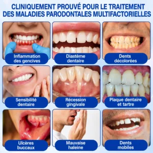 Glimmerly GumRevive - Gel de Réparation Parodontale - Image 6