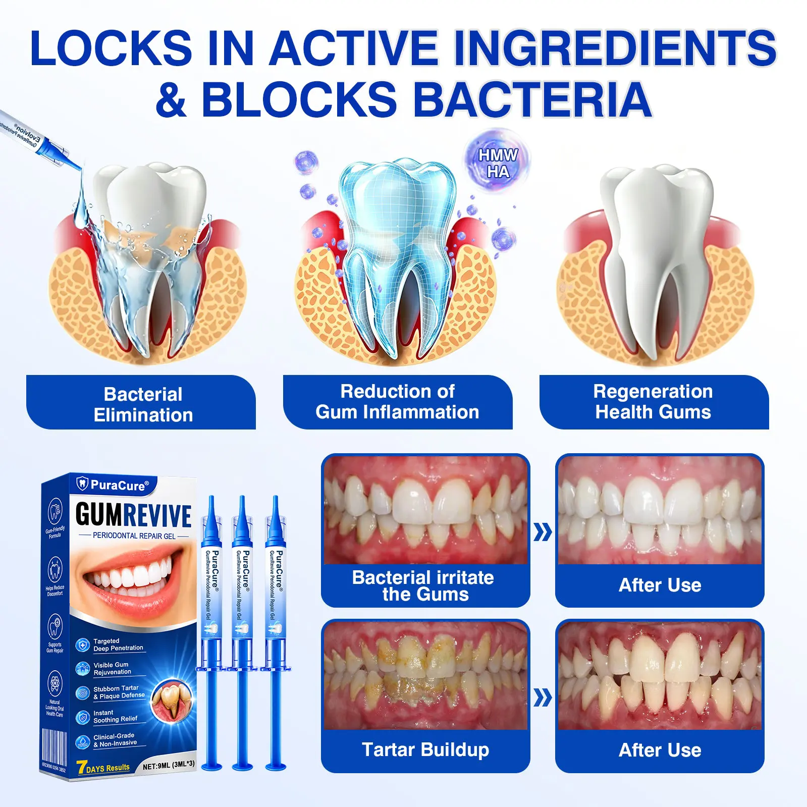 Periodontal Repair Gel - Image 7