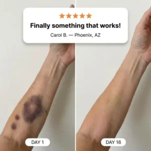 Bruise Repair Cream - Image 6