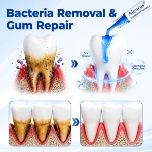 Periodontal Recovery Gel - Image 3