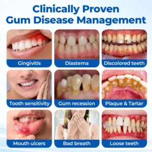 Periodontal Recovery Gel - Image 4