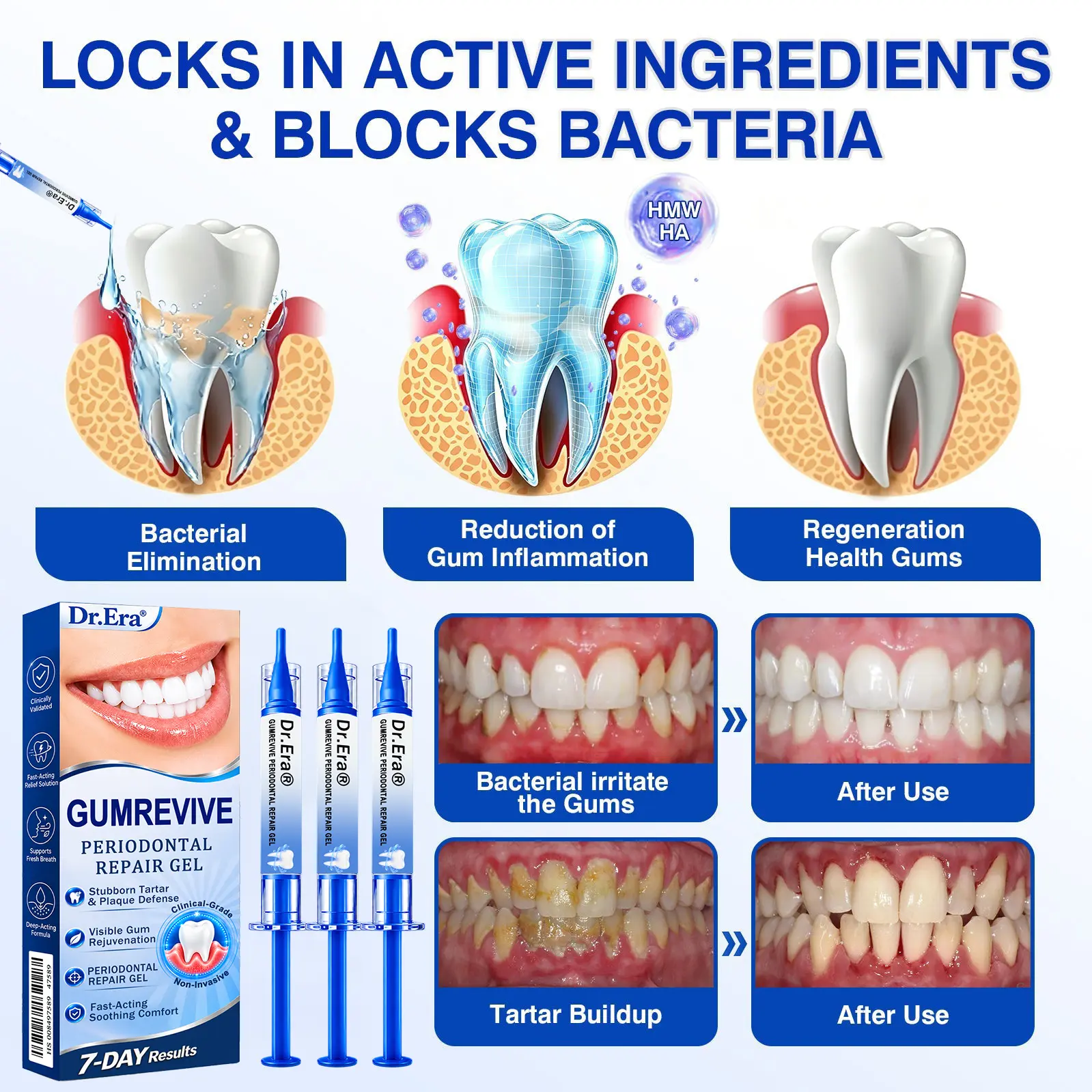 GumRevive Periodontal Repair Gel - Image 8