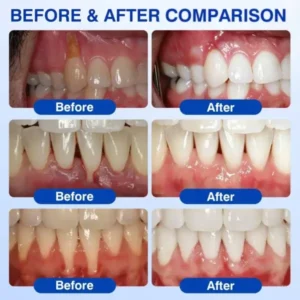 GumVital Gum Care Gel - Image 15