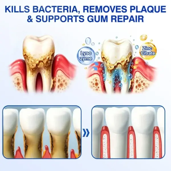 GumVital Gum Care Gel - Image 17