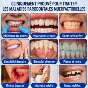 Gel Parodontal - Image 11