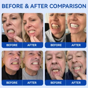 GumRevive Periodontal Repair Gel - Image 2