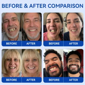 GumRevive Periodontal Repair Gel - Image 3