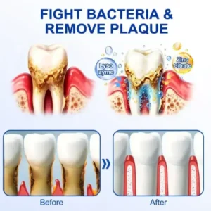 Periodontal Gel - Image 14