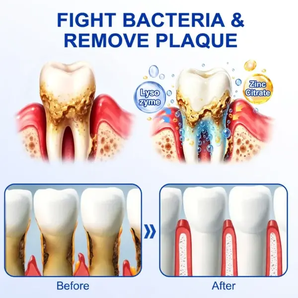 GumRevive Periodontal Repair Gel - Image 14