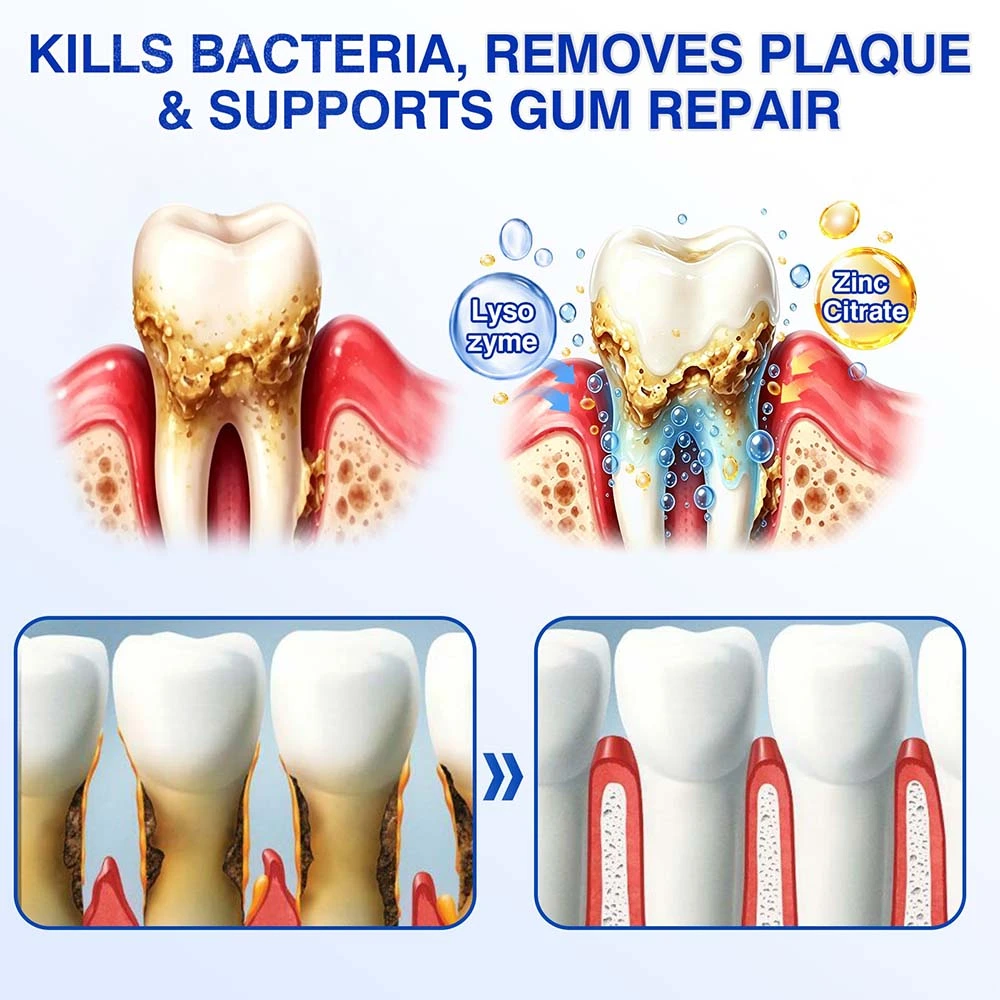GumRevive - Image 11