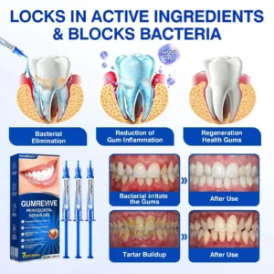 GumRevive Periodontal Repair Gel - Image 3