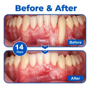 GumRevive - Image 4