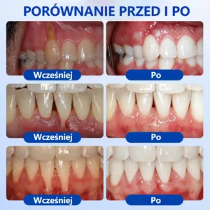 GumRevive - Image 6
