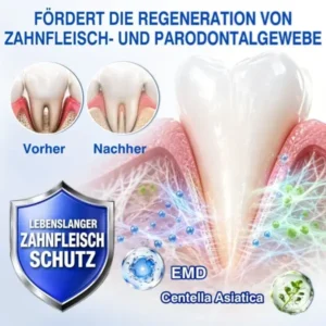 GumRevive Parodontal-Reparaturgel - Image 10