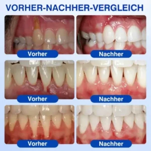 GumRevive Parodontal-Reparaturgel - Image 12