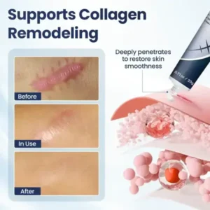 Texture Repair Gel - Image 4