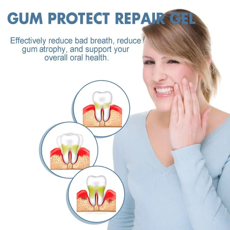 Nocztuce GumCare Support Gel - Image 2