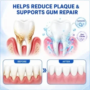 Periodontal Care Gel - Image 13