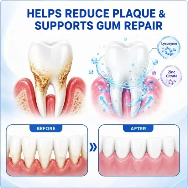 Periodontal Care Gel - Image 13