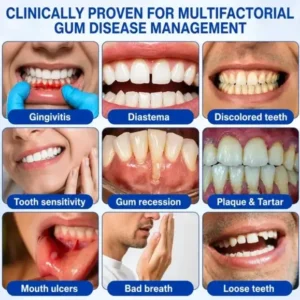 Periodontal Care Gel - Image 7