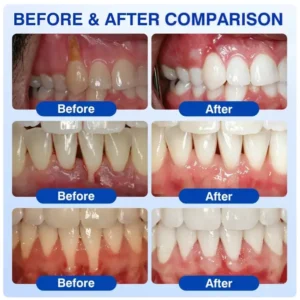 GumRevive Periodontal Care Gel - Image 3