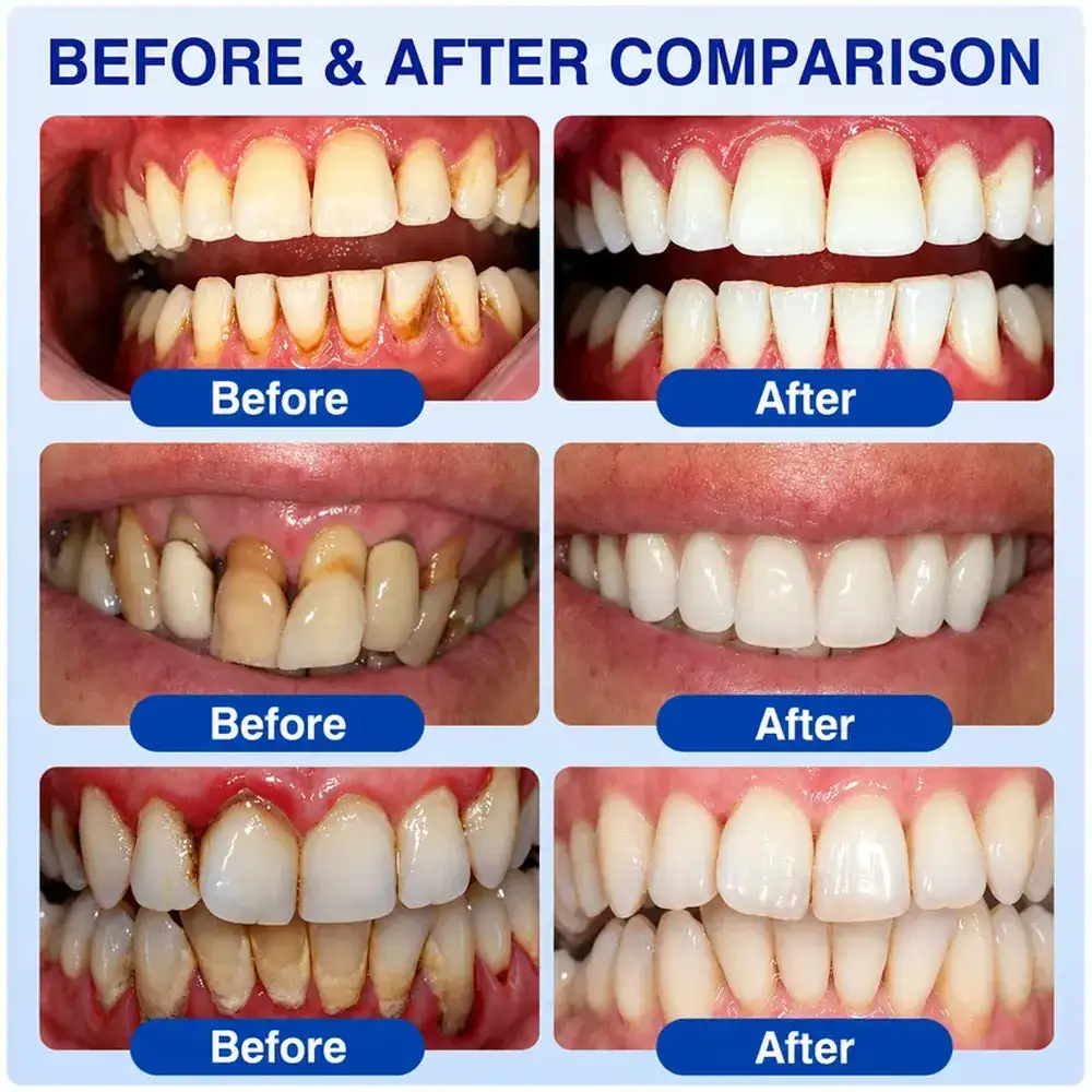 GumRevive Periodontal Care Gel - Image 4