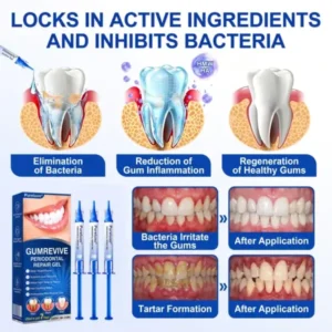GumRevive Periodontal Repair Gel - Image 8