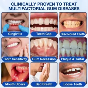 GumRevive Periodontal Repair Gel - Image 3