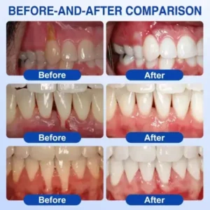GumRevive Periodontal Repair Gel - Image 16