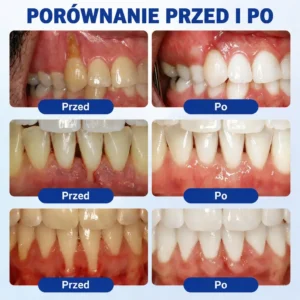 GumRevive - Image 3