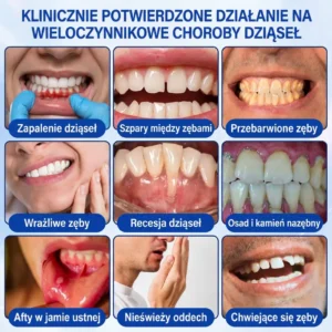GumRevive - Image 6