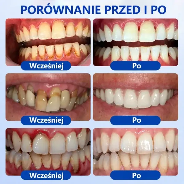 𝑮𝒖𝒎𝑹𝒆𝒗𝒊𝒗𝒆 Ż𝒆𝒍 𝒅𝒐 𝒓𝒆𝒈𝒆𝒏𝒆𝒓𝒂𝒄𝒋𝒊 𝒅𝒛𝒊ą𝒔𝒆ł - Image 4