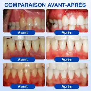 𝑮𝒖𝒎𝑹𝒆𝒗𝒊𝒗𝒆 𝑮𝒆𝒍 𝒅𝒆 𝑹é𝒑𝒂𝒓𝒂𝒕𝒊𝒐𝒏 𝑷𝒂𝒓𝒐𝒅𝒐𝒏𝒕𝒂𝒍𝒆 - Image 3